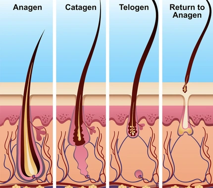 HAIR LOSS AFTER BARIATRIC SURGERY