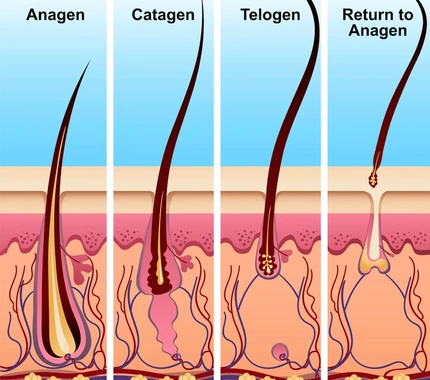 HAIR LOSS AFTER BARIATRIC SURGERY